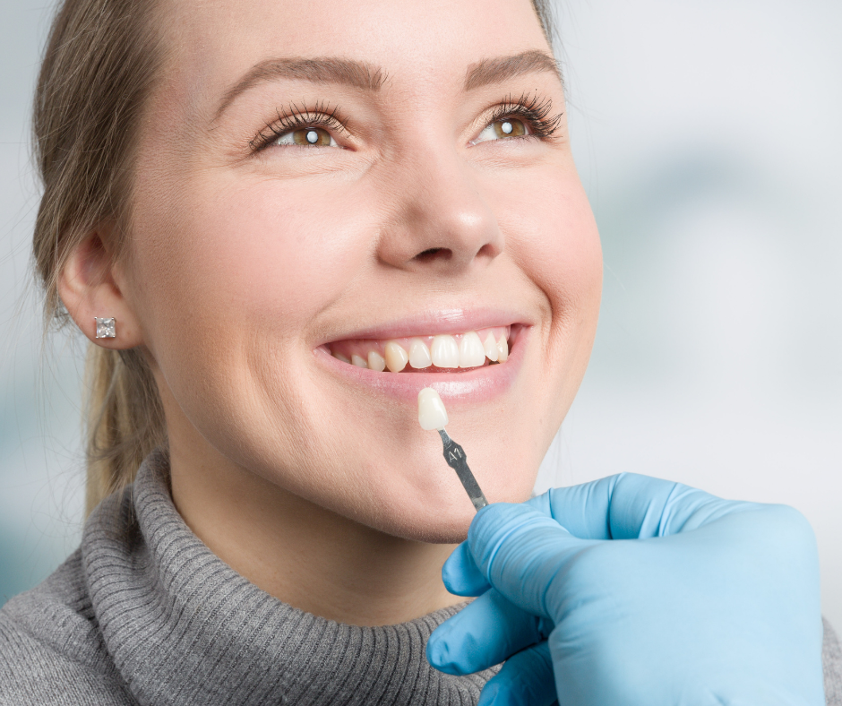 Facetas de porcelana